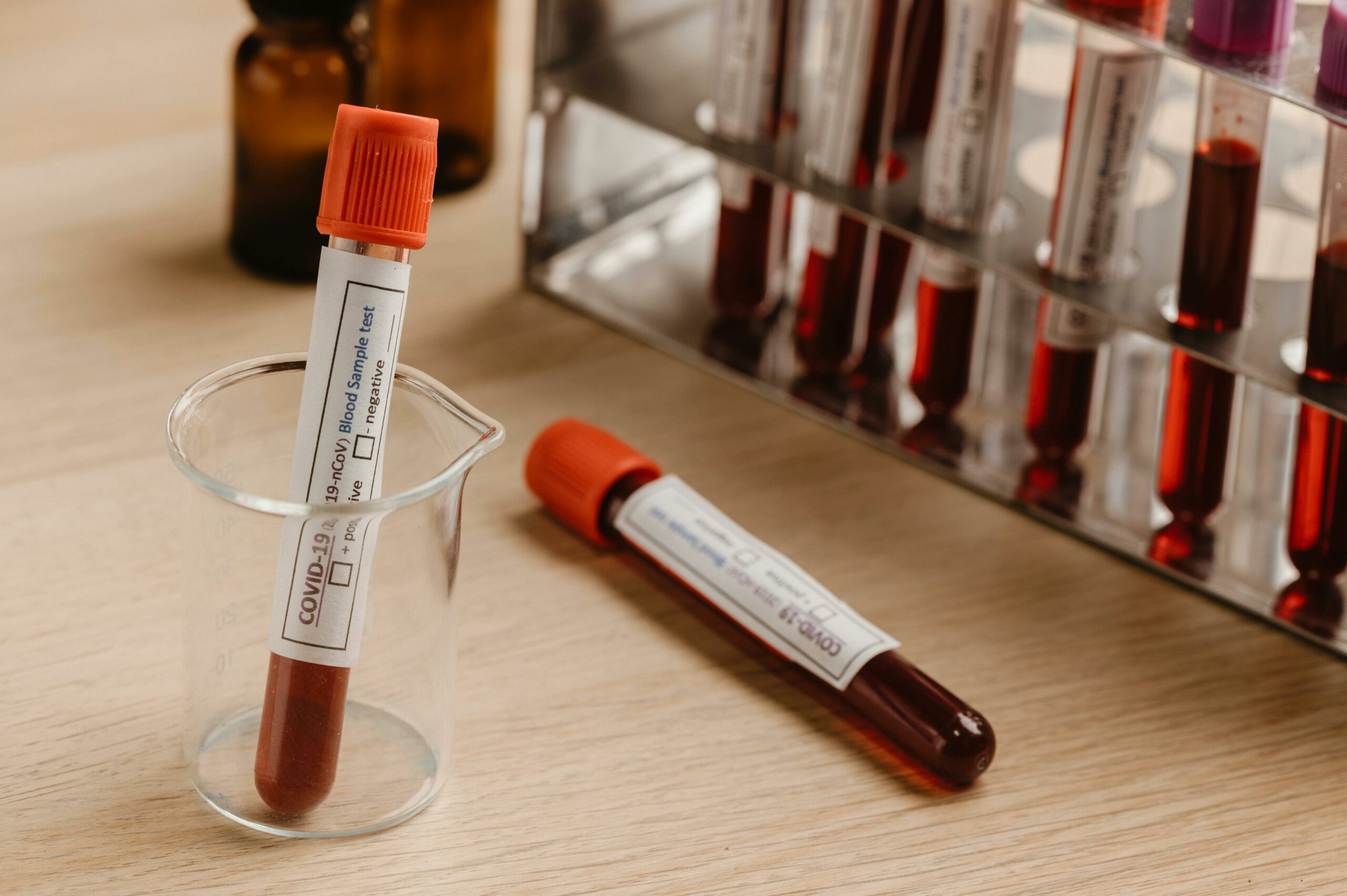 Close-up of blood sample tubes for Covid-19 testing in a laboratory setting.
